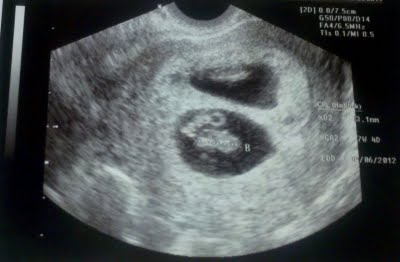 Childs ultrasound
