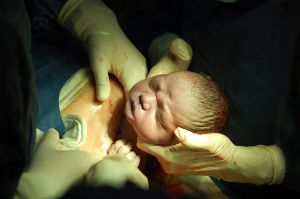 baby being born