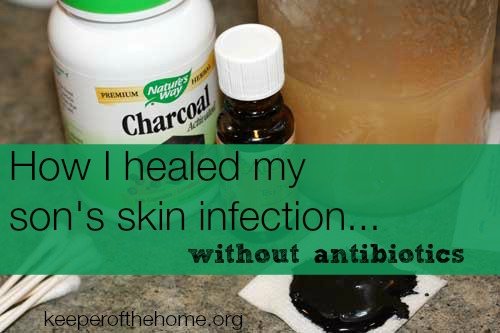 Here's how one mom was able to naturally heal infection without antibiotics – and how you can too! 