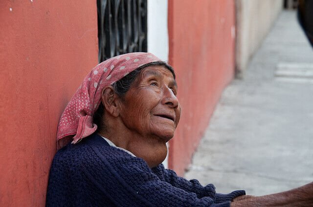 goiter on South American Woman