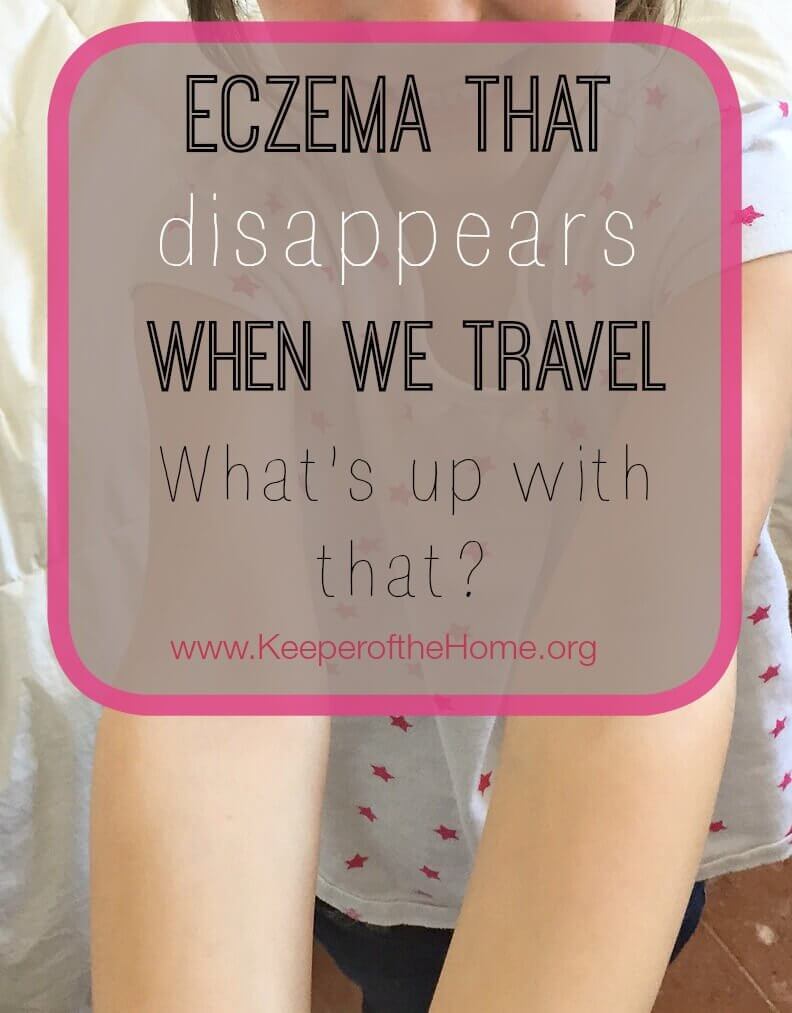 Eczema That Disappears When We Travel? What's Up With That? 4